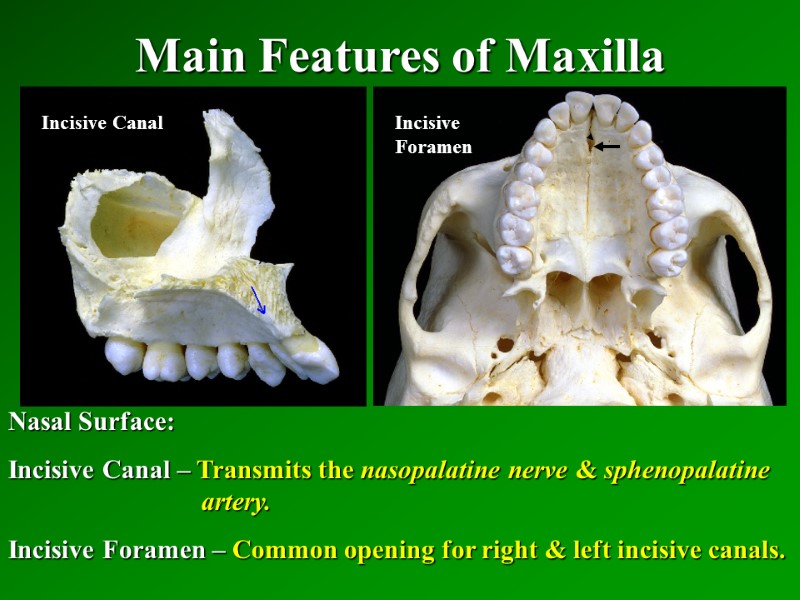 Main Features of Maxilla   Nasal Surface: Incisive Canal – Transmits the nasopalatine